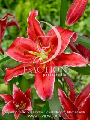 Red Reflex